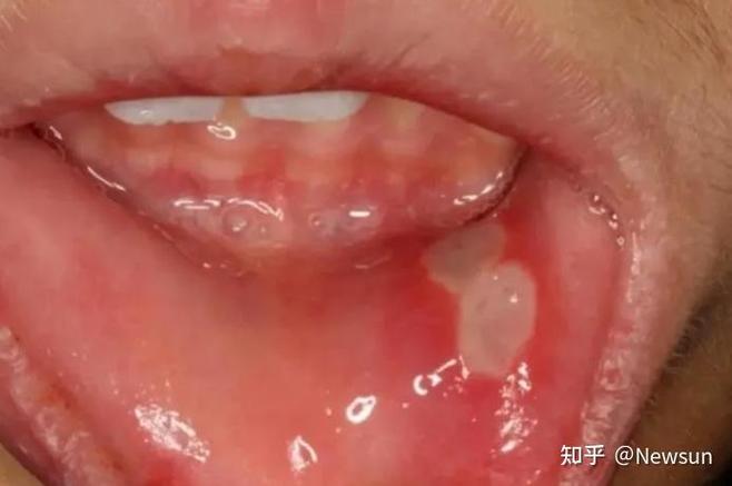 新闻中心 第10页